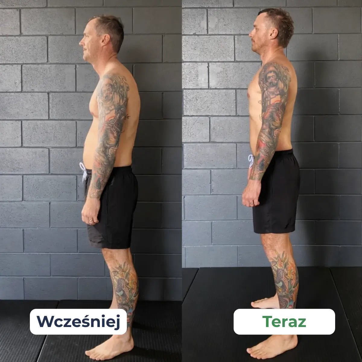 Posteo™ | Korektor postawy dla pleców, szyi i ramion